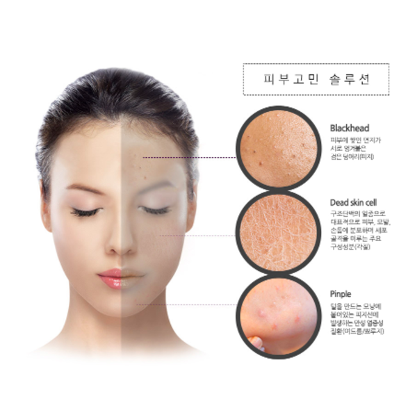 Активна киснева маска на основі вугля для глибокого очищення шкіри PUREDERM Deep Purifying Black O2 Bubble Mask Charcoal 4209 фото