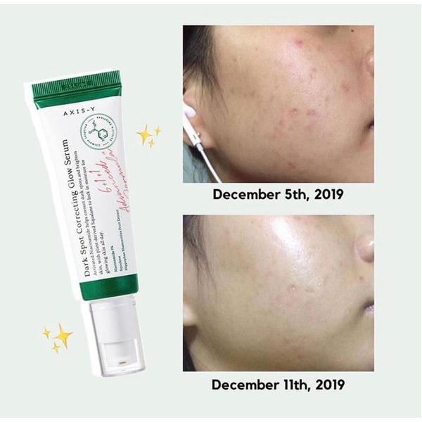 Сыворотка для коррекции темных пятен Axis-Y Dark Spot Correcting Glow Serum M007466 фото