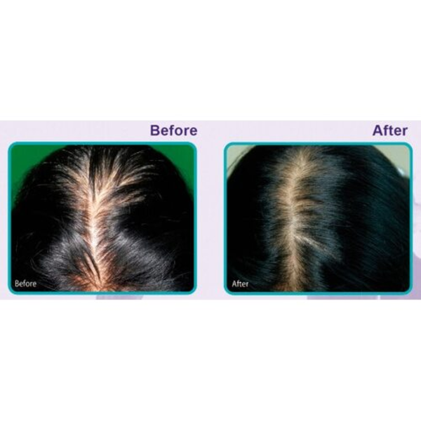Регенерирующая эмульсия для кожи головы против выпадения волос DAENG GI MEO RI Vitalizing Scalp Pack For Hair-Loss 3914 фото
