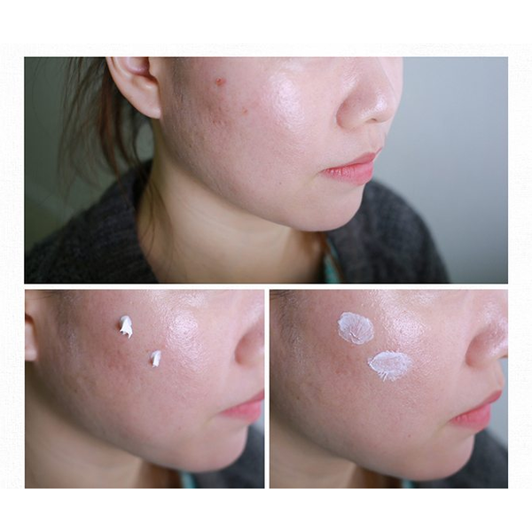 Загоювальний крем з центелою COSRX Centella Blemish Cream 2613 фото