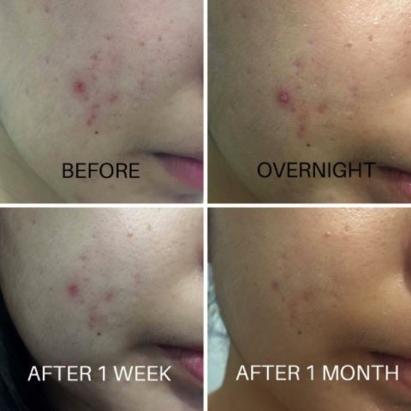 Загоювальний крем з центелою COSRX Centella Blemish Cream 2613 фото