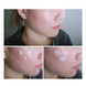 Загоювальний крем з центелою COSRX Centella Blemish Cream 2613 фото 2