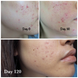 Загоювальний крем з центелою COSRX Centella Blemish Cream 2613 фото 4