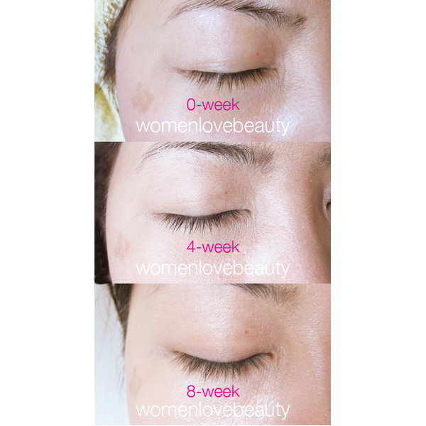 Лікувальна сироватка для росту і зміцнення вій Etude My Lash Serum 498 фото
