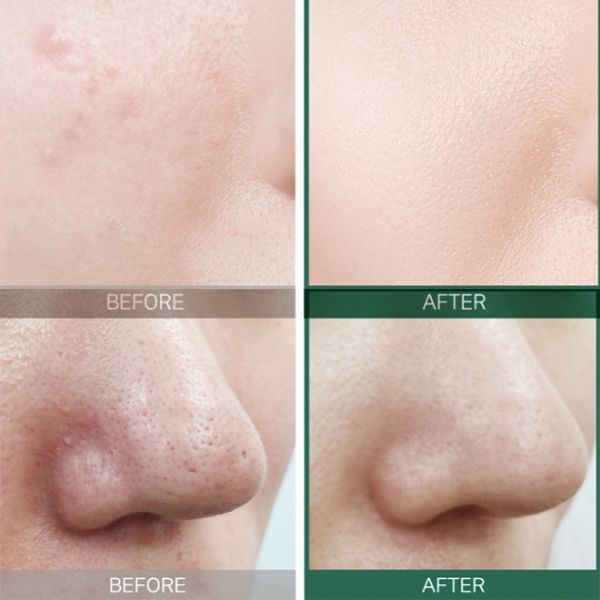 Відновлювальний крем для проблемної шкіри SOME BY MI AHA/BHA/PHA 30 Days Miracle Cream 2282 фото