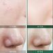 Відновлювальний крем для проблемної шкіри SOME BY MI AHA/BHA/PHA 30 Days Miracle Cream 2282 фото 2