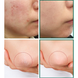 Відновлювальний крем для проблемної шкіри SOME BY MI AHA/BHA/PHA 30 Days Miracle Cream 2282 фото 3